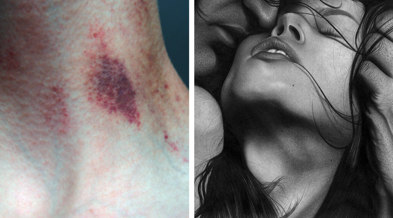 Visita medica medica a osteochondrosis