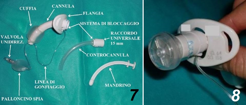Tracheostomia E Cannule Tracheostomiche Gestione Infermieristica Tracheostomia E Cannule Tracheostomiche Gestione Infermieristica