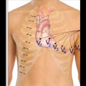 ECG ADULTO