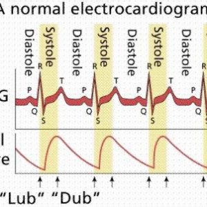 ECG DOK