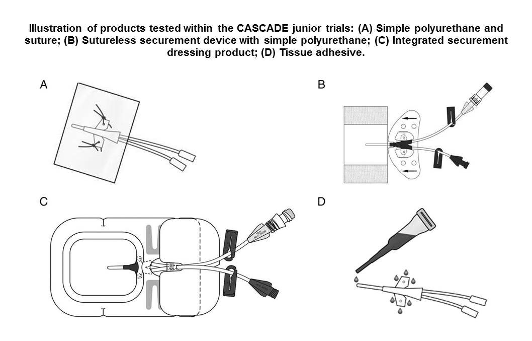 Gestione del sito di emergenza dei PICC 1