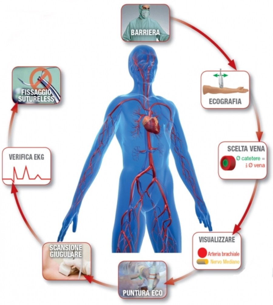 In Calabria eccellenza infermieristica: il Picc Team diventa Vascular Team Oncology 3