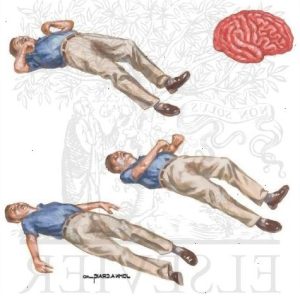 Epilessia e diagnosi: lo studio ENIGMA