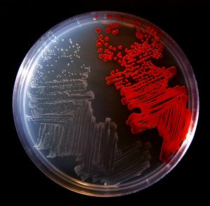 Serratia Marscens e le epidemie nelle Terapie Intensive Neonatali, sono davvero così rare? 1