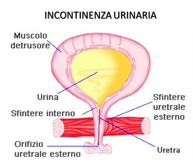 Vescica neurologica