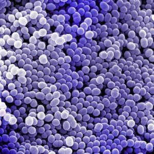 Iniezioni intramuscolari: disinfettare o non disinfettare la cute?