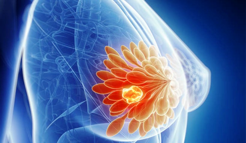 terapia iniettiva per carcinoma prostatico terapia iniettiva per carcinoma prostatico