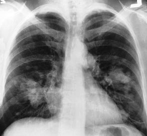 Il rapporto infermiere-paziente: storie di tutti i giorni