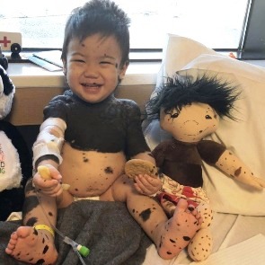 A Doll Like Me: la bambola che aiuta i bimbi malati ad accettare la loro “diversità” 2