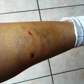 Catania, Fials lancia l’allarme randagismo