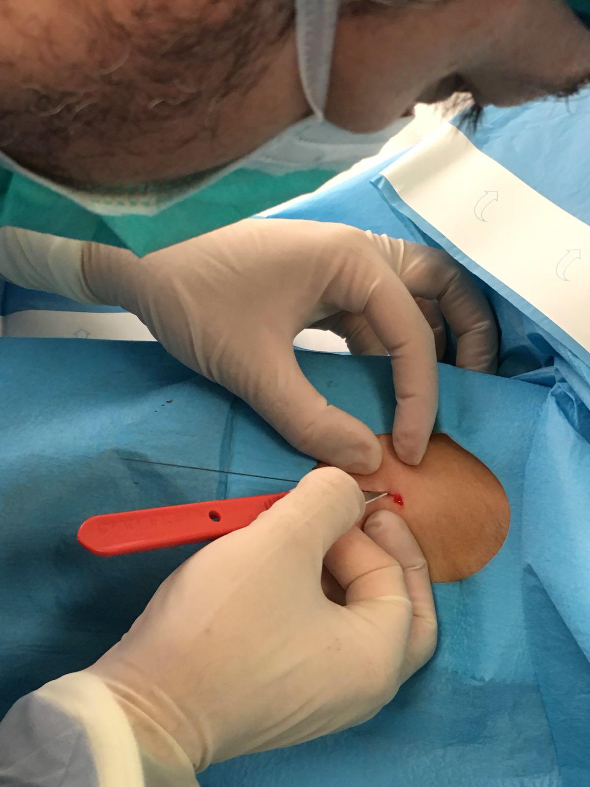 Speciale NurseTimes. Intervista a Filippo Carlucci referente del Team Infermieristico Accessi Vascolari 1