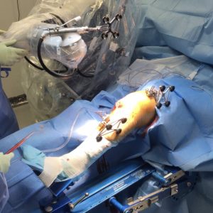 La chirurgia robotica: una nuova frontiera tecnologica al servizio del chirurgo 2