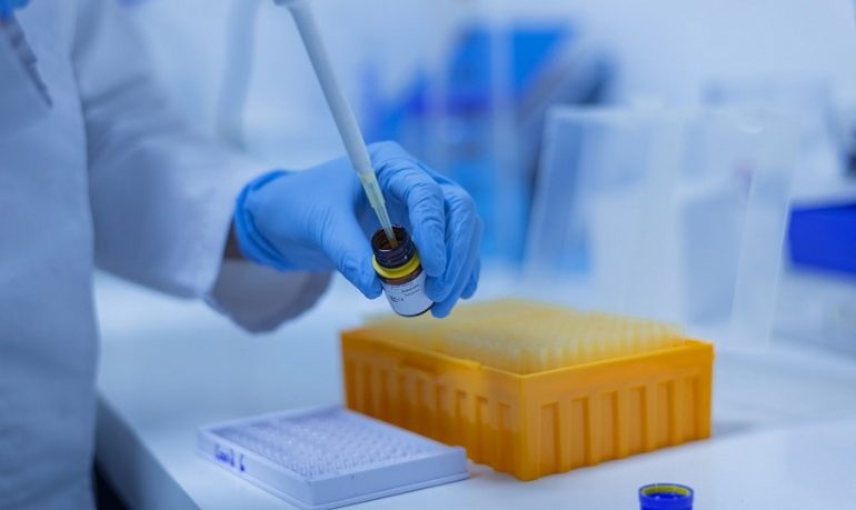 Coronavirus E Una Donna Il Primo Caso Di Variante Inglese In Italia Ue In Stato Di Allerta Nurse Times