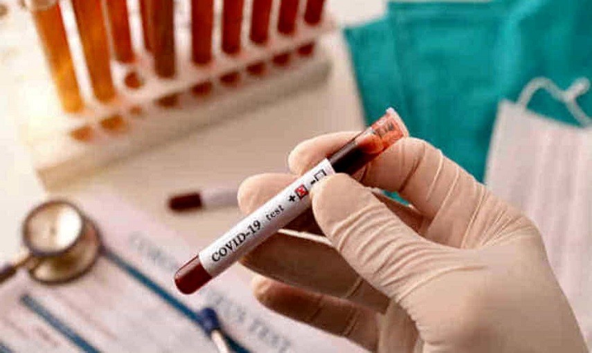 Coronavirus, anticorpi restano 6 mesi nel sangue dei guariti | Nurse Times